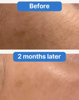 Fade Away Brightening Serum